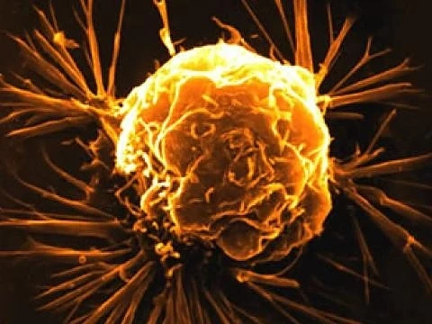 Тест предсказва 100% дали човек ще развие рак