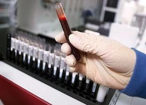 Британци разработили нов метод  за унищожаване на ракови клетки