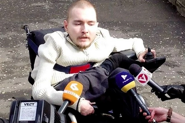 Първата трансплантация на глава ще трае 36 часа