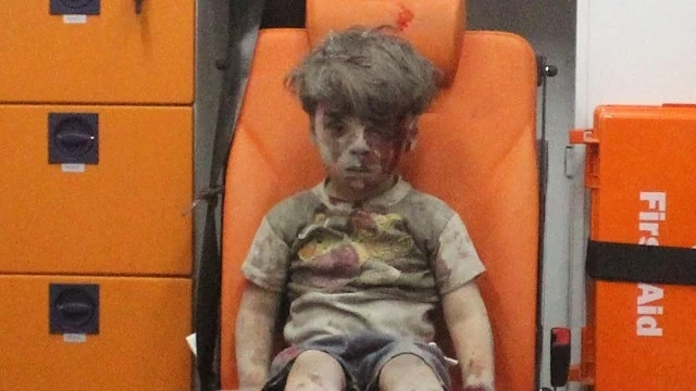 Номинираха за Нобелова награда сирийските „Бели каски”, спасили Омран 