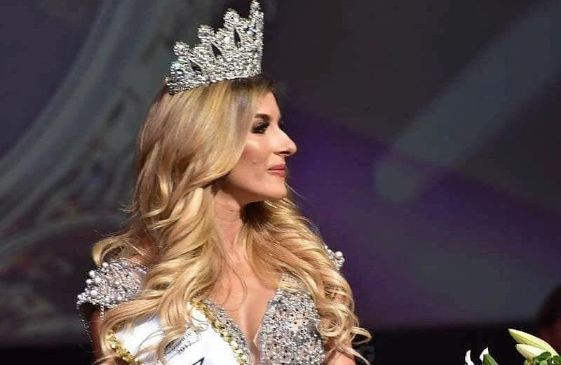 Мис България 2017 проговори: Носът ми остава на заден план 