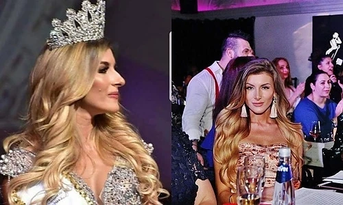 Мис България си направи същия нос като на свекърва си