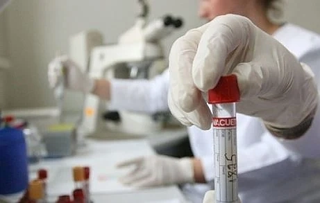 Регистриран е нов случай на грип в Бургаско