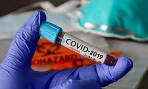 Българка взе 3500 паунда, за да я заразят с COVID-19