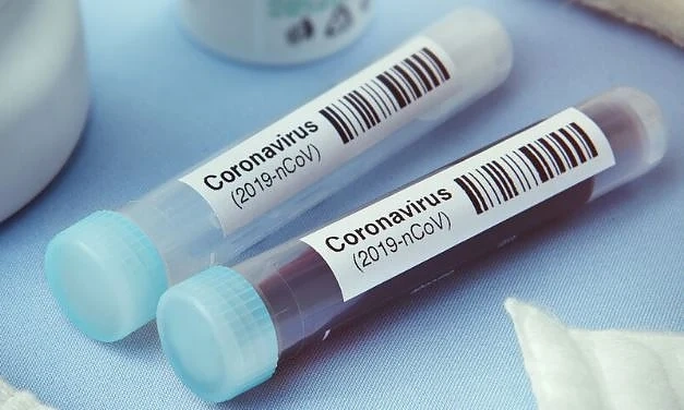 Българска студентка в Лондон се съгласила да я заразят с коронавирус