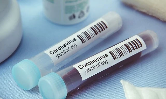 Осемте съмнителни проби, изследвани за коронавирус, са отрицателни