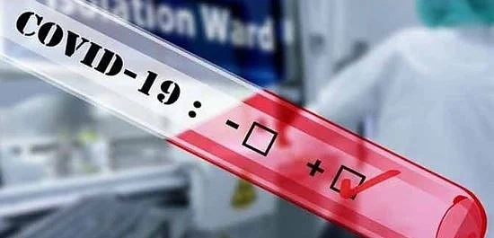 Първа положителна проба за COVID-19 във Варна