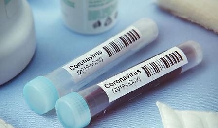 Правят PCR тестове за COVID-19 в болница „Токуда” 