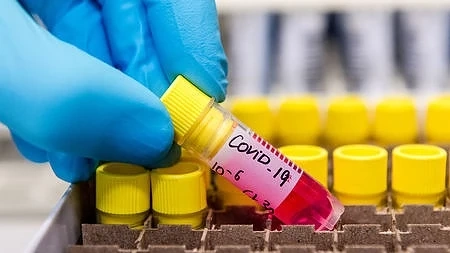 Утре представят информационна система за борба с COVID-19