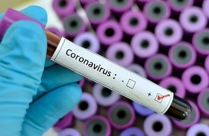 618 са вече потвърдените случаи на COVID-19 у нас