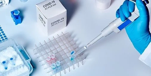 Купуваме 30 000 PCR теста за COVID-19 от Южна Корея