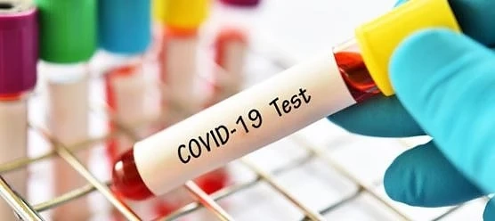 713 станаха потвърдените случаи на COVID-19