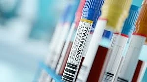 Учени от Харвард: Вирусът ще остане до 2024, периодични карантини до 2022