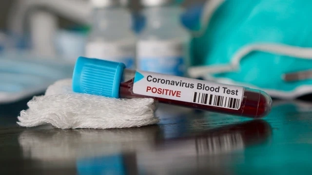 Случаите на COVID-19 у нас вече са 1015