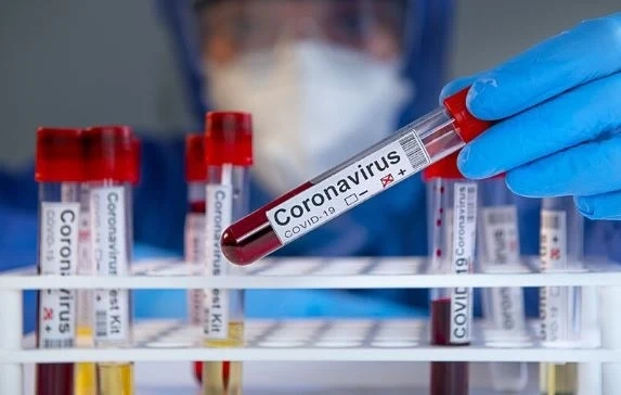 1188 са потвърдените случаи на COVID-19 у нас, има още двама починали 