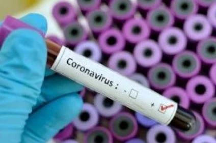 СЗО: Новият епицентър на COVID-19 е Южна Америка