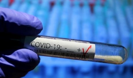 Учени: COVID-19 поразява кожата седмици след оздравяването
