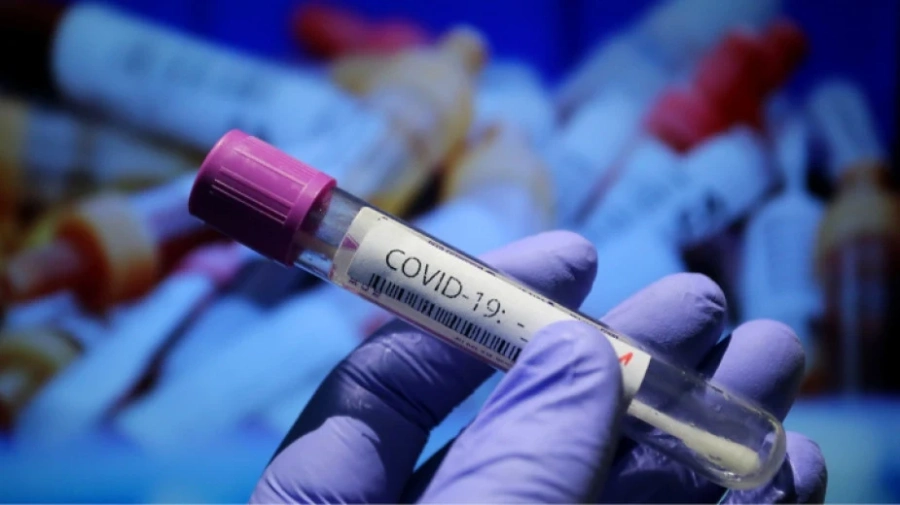 8 са новите случаи на COVID-19 у нас, 51 души са излекувани