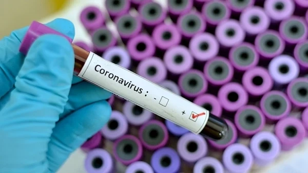 51 станаха случаите на коронавирус в цеха за играчки в Доспат