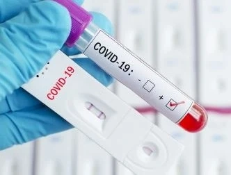 79 са новите случаи на COVID-19 у нас 