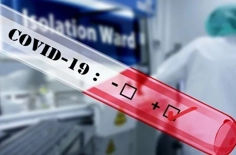 Регистрирани са 105 нови случая на Covid-19 у нас
