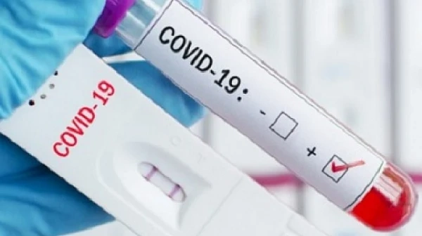 90 нови заразени с COVID-19 у нас