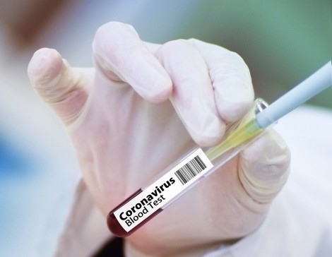 286 са новите случаи на коронавирус у нас