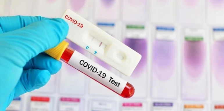 240 новозаразени с COVID-19 у нас, още 6 души починаха