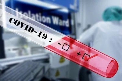 86% от заразените с COVID-19 нямат симптоми в деня на теста