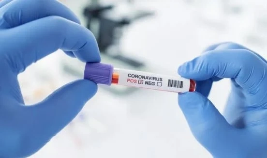 1 472 са новите случаи на COVID-19. Починалите са 29  