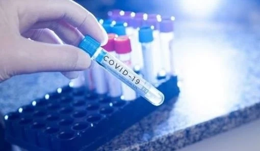 2427 нови случая на COVID-19 у нас, 51 са починали