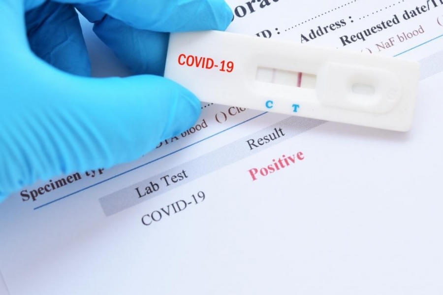 2814 заразени и над 200 починали от COVID-19 за денонощие