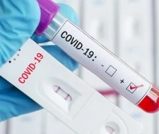 3614 са новозаразени и 147 починали от COVID-19 за денонощие у нас