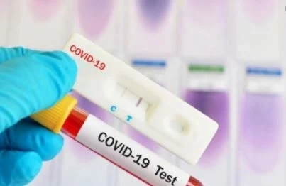 3980 са новите случаи на COVID-19 у нас
