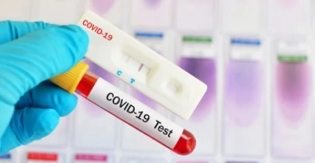 497 новозаразени с COVID-19 у нас