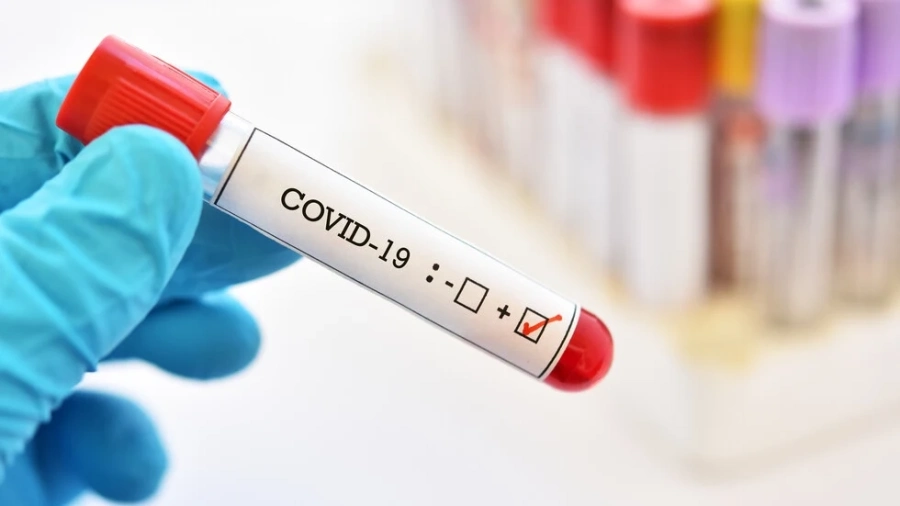 В пъти повече са излекувани от COVID-19 от заразените за последното денонощие у нас