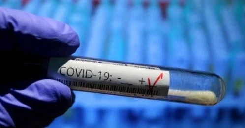 70 починали с COVID-19 за последното денонощие