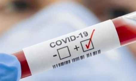266 нови случая на COVID-19 у нас