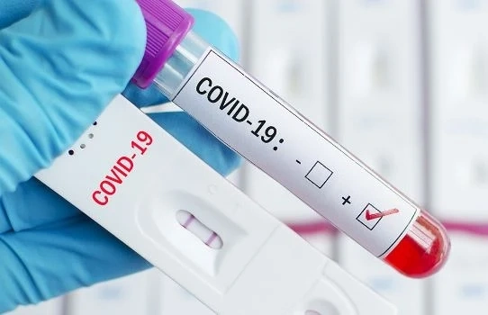 827 нови случая на COVID-19 в страната