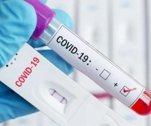 Новите случаи на COVID-19 у нас леко намаляват