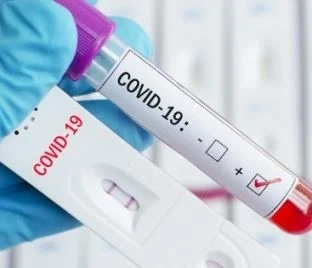 506 са новите случаи на COVID-19 у нас