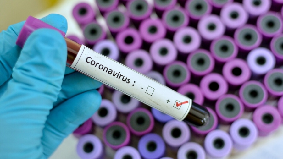 631 са новите случаи на коронавирус у нас