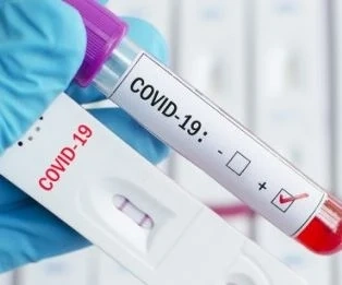 Новите случаи на COVID-19 са под 10%