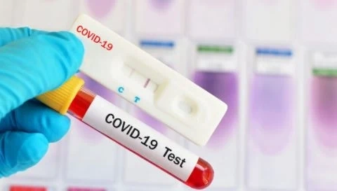 Под 100 са новите случаи на COVID-19 у нас