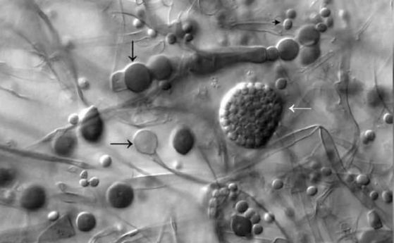 Нова епидемия в Индия: черната гъба