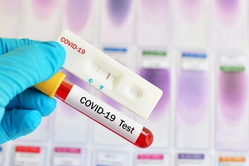 Нисък брой заразени с COVID-19 у нас