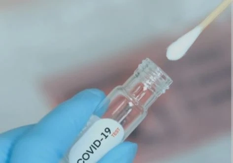 61 са новите случаи на COVID-19 у нас