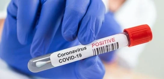 Отново ръст на заразените с COVID-19 у нас