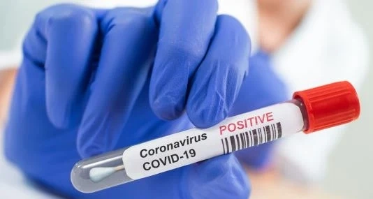 Близо 900 са новите случаи на COVID-19 у нас
