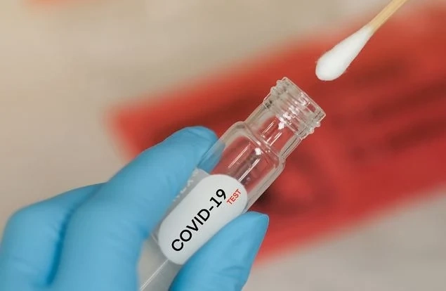 27 жертви на COVID-19 за ден у нас